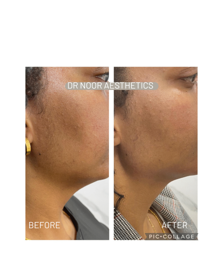 PIGMENTATION